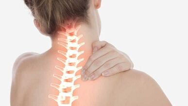 Las principales manifestaciones de la osteocondrosis cervical