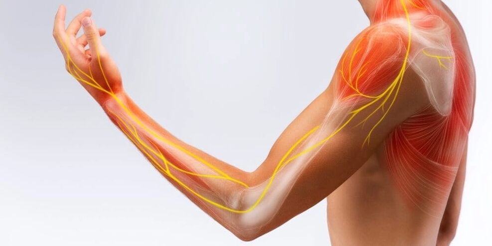 El dolor y el entumecimiento en los dedos indican daño a los ligamentos debido a ligamentitis estenosante.
