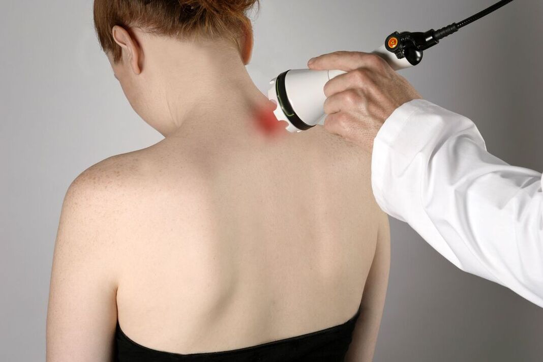 Tratamiento fisioterapéutico de la osteocondrosis cervical.